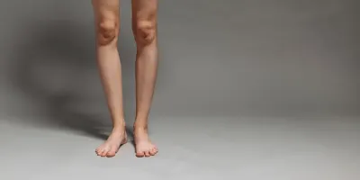 다리에 핏줄이 도드라진다면 — 하지정맥류일 때 마사지 압과 방향
